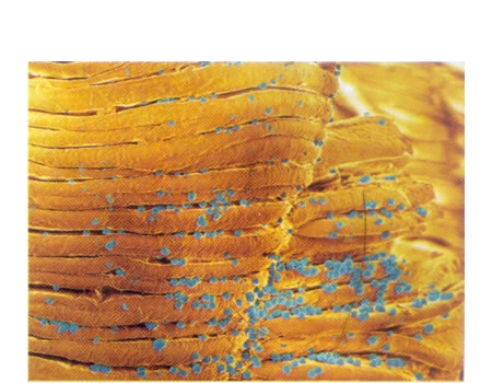 Bacterias quimiosintéticas del fondo del mar (color azul) en la superficie de un gusano. Estas bacterias viven en las chimeneas hidrotermales del fondo del mar, llamadas humeros hidrotermales, a unos 2.600 m de profundidad. La luz del Sol no llega, por l